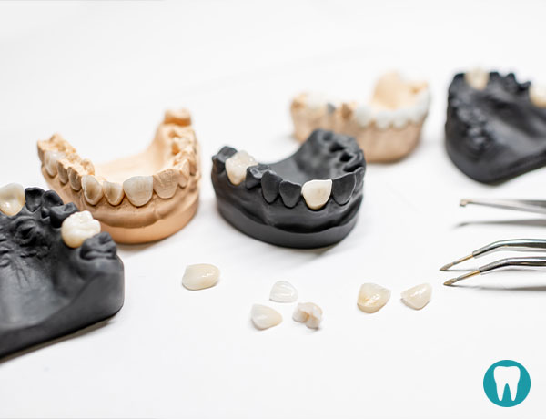 Metalokeramičke krunice